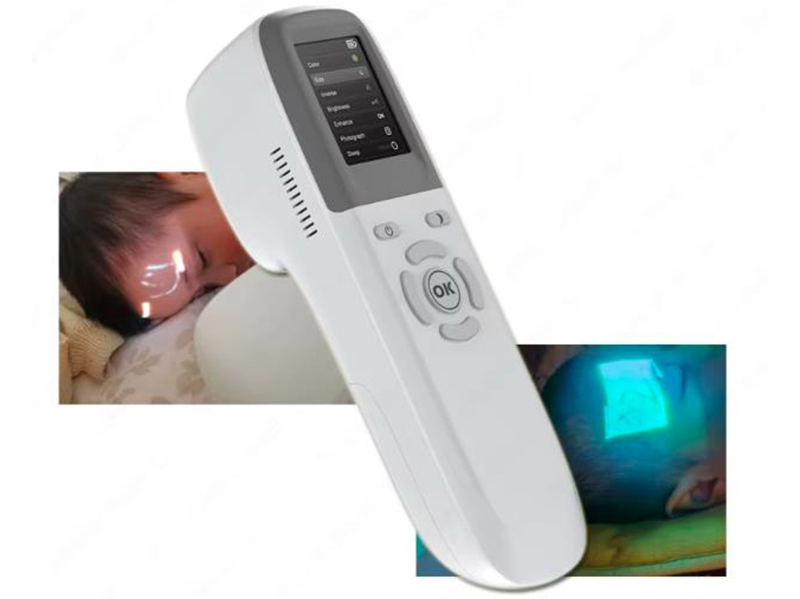 V600 vein finder
